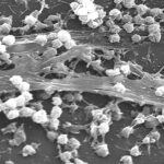 Des essaims de nanorobots magnétiques pour déstructurer les biofilms bactériens