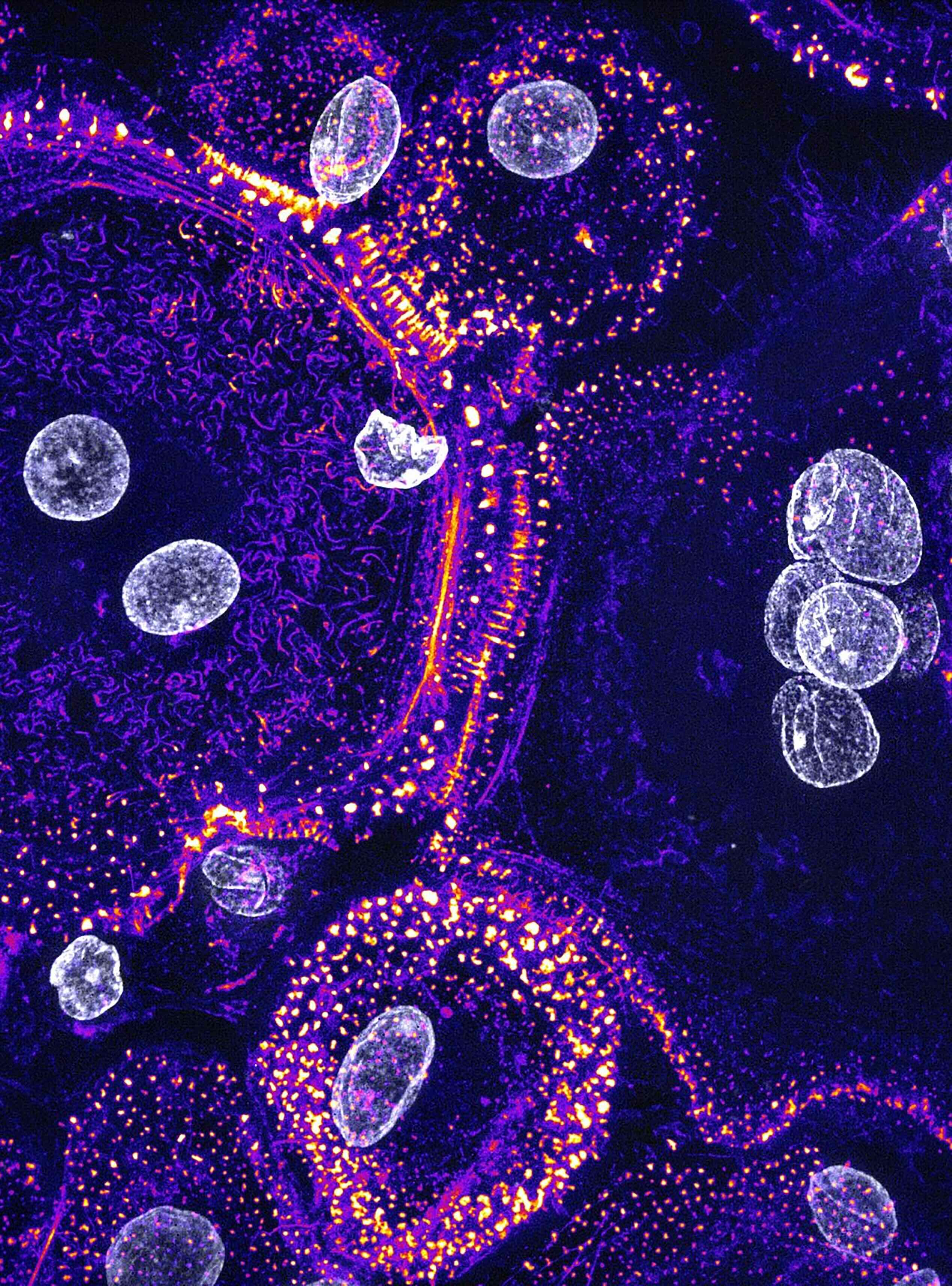 Moesin Protein Controls Bone Remodeling by Regulating Osteoclast Fusion and Function