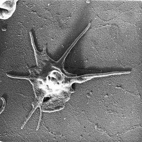 Plaquette © Etienne DELAIN/CNRS Images